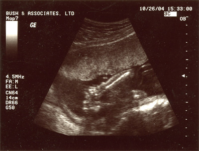 Image Alternate text